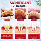 (Buy 1 Get 1 Free) SP-4 Probiotic Brightening and cleaning toothpaste